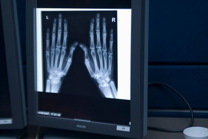 צילום רנטגן של כפות ידיים 🖼️ emanueletudisco photography cc-by-nc-nd